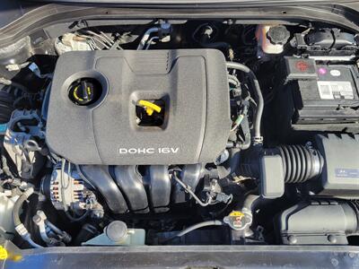 2018 Hyundai ELANTRA SEL - Photo 5 - Fortuna, CA 95540