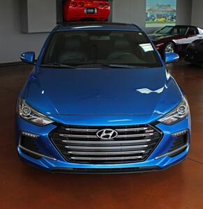 2017 Hyundai Elantra Sport   - Photo 4 - North Canton, OH 44720