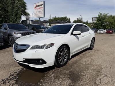 2017 Acura TLX SH-AWD V6 w/Advance - Photo 3 - Edmonton, AB T5W 1E5