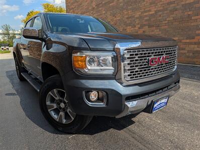2018 GMC Canyon Denali AWD - Duramax 2.8L Diesel Turbo - Crew Cab - Navigation - Backup Camera - Bluetooth - 1 Owner - NO Accident - Clean Title - All Serviced - Photo 3 - Wood Dale, IL 60191