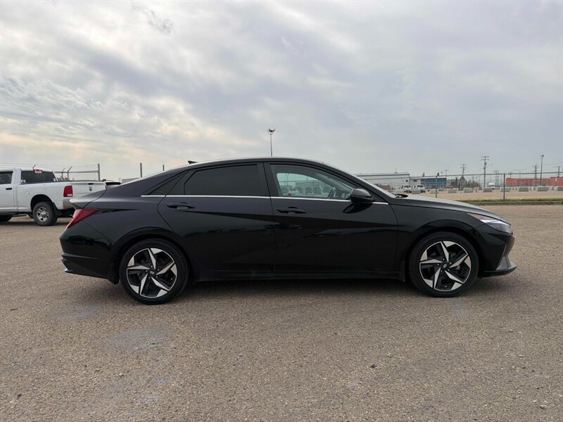 2023 Hyundai ELANTRA Hybrid Luxury - Photo 5 - Edmonton, AB T5L 2J7