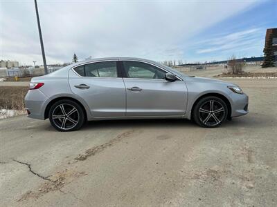 2017 Acura ILX w/Premium   - Photo 5 - Acheson, AB T7X 5A3