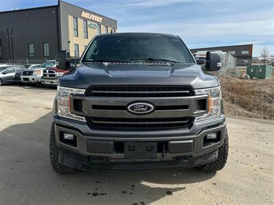 2018 Ford F-150 XLT 4x4 - Photo 2 - Acheson, AB T7X 5A3