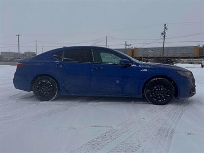 2020 Acura TLX SH-AWD V6 w/Advance   - Photo 5 - Edmonton, AB T5L 2J7