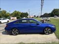 2024 Hyundai Elantra SEL - Thumbnail 6