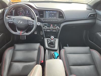 2020 Hyundai ELANTRA Sport   - Photo 5 - Edmonton, AB T6E 6B3