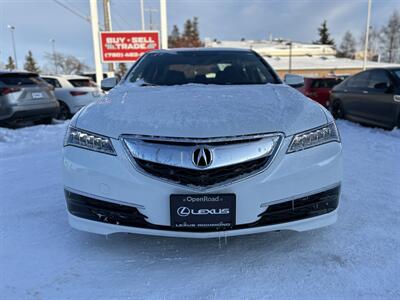 2017 Acura TLX SH-AWD V6 w/Tech | Loaded | Backup Camera |   - Photo 2 - Edmonton, AB T5S 1R1