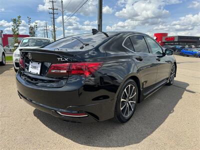 2016 Acura TLX SH-AWD V6 | A-SPEC KIT | BACKUP CAM |   - Photo 4 - Edmonton, AB T5S 1R1