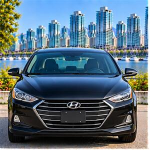2018 Hyundai ELANTRA SEL Sedan