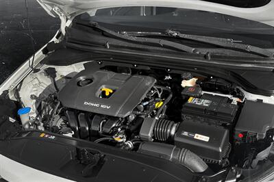 2018 Hyundai ELANTRA SEL   - Photo 10 - Edmonton, AB T6B 0B7