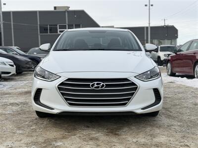 2017 Hyundai ELANTRA SE   - Photo 2 - Edmonton, AB T5S 1R1