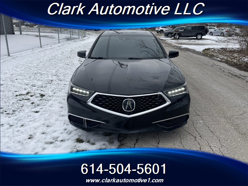 2018 Acura TLX Technology Package's photo