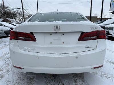 2016 Acura TLX SH-AWD w/Elite - Photo 6 - Edmonton, AB T5G 0N9