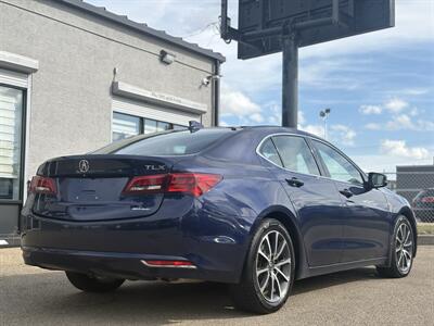 2015 Acura TLX SH-AWD V6 w/Tech   - Photo 3 - Edmonton, AB T6B 0B7